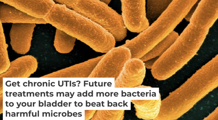 Certain strains of E. coli can outcompete disease-causing microbes for resources. NIAID/Flickr, CC BY-SA